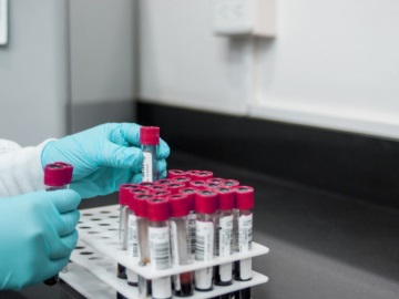 Ερευνητές αναπτύσσουν εξέταση αίματος που θα προβλέπει τον κίνδυνο εμφάνισης άνοιας μια δεκαετία πριν τη διάγνωση