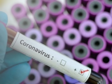 Δωρεά σε ΕΚΠΑ και ΑΠΘ 20.000 διαγνωστικών τεστ για τον κορωνοϊό - Από το Ίδρυμα Λάτση και την Συν-Ένωσις