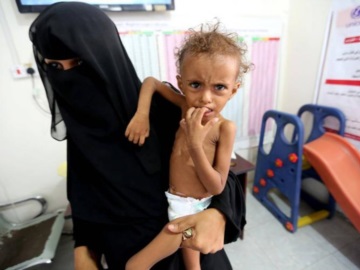 UNICEF: Εκατομμύρια παιδιά αντιμέτωπα με τη λιμοκτονία στην Υεμένη 