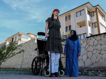 Η πιο ψηλή γυναίκα του κόσμου είναι από την Τουρκία