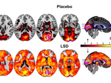 Έλληνες και Βρετανοί επιστήμονες έριξαν περισσότερο φως στον τρόπο που το LSD δουλεύει στον εγκέφαλο