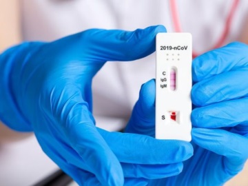 Αίγινα: «Διενέργεια δωρεάν Rapid Test από το Κέντρο Υγείας και το Δήμο Αίγινας»