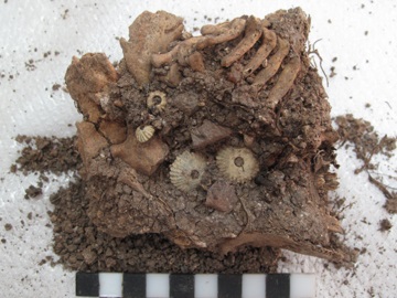 Αίγινα: Ανασκαφή έφερε στο φως σκελετό μωρού με σύνδρομο Down που έζησε τον 13ο αιώνα π.Χ